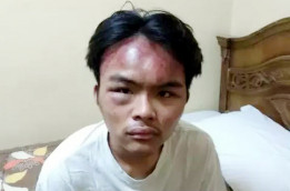 Mahasiswa Indonesia di Kairo Brutal, Dilaporkan ke Polisi Mesir 