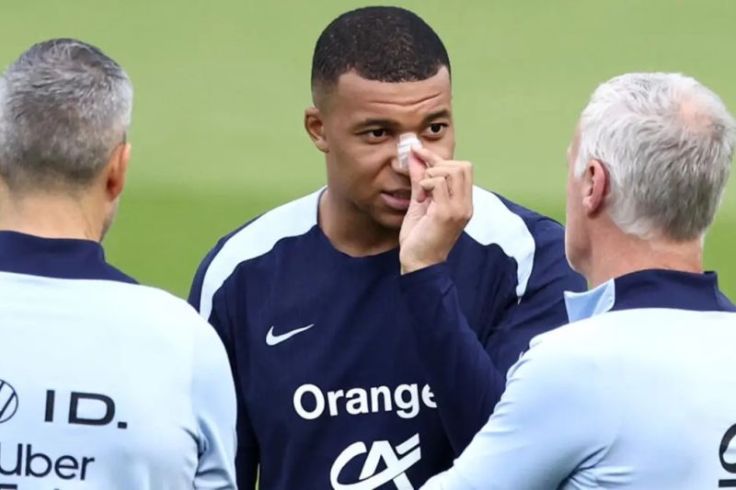 Patah  Hidung, Kylian Mbappe Nekat akan Main Lawan Belanda