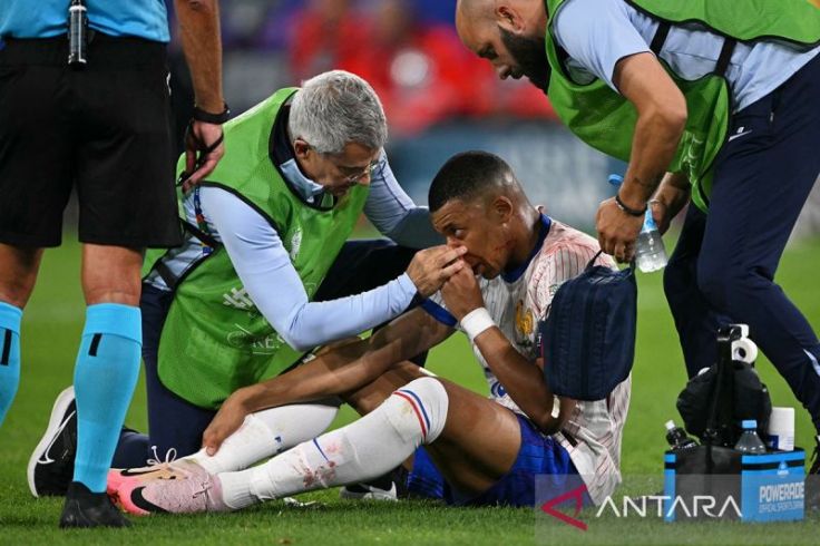 Hidung Patah, Kylian Mbappe Duduk di Bangku Cadangan saat Hadapi Belanda