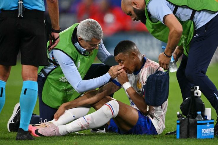 Duh Mbappe Berdarah-darah, Tulang Hidungnya Patah