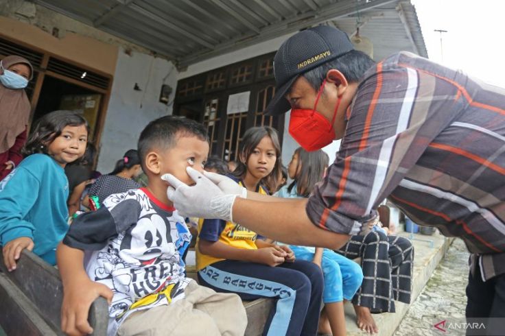 Waspadalah! Gejala Hepatitis Anak Tak Selalu Mata Kuning  