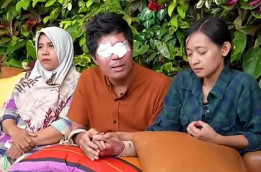 Babak Baru Drama Korban Penyiraman Air Keras Agus Salim