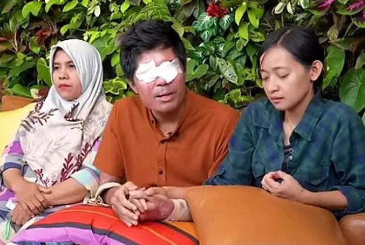 Babak Baru Drama Korban Penyiraman Air Keras Agus Salim