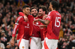 Arteta Nilai MU Kini Lebih Kuat Jelang Duel Kontra Arsenal